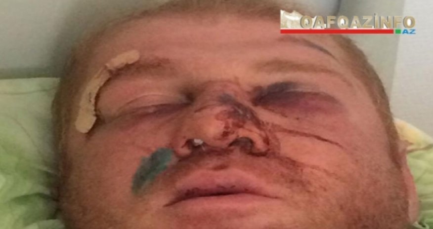 Bakıda beşqat dünya çempionunu bıçaqladılar - VİDEO