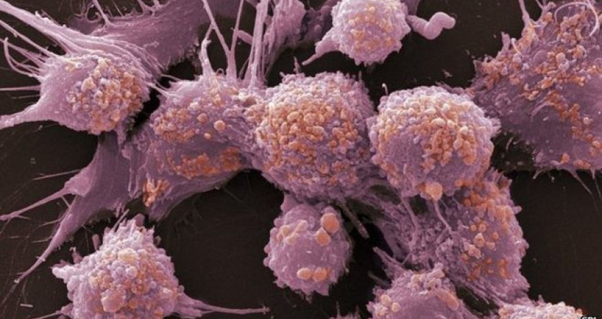 Prostate cancer drug 'extends lives'