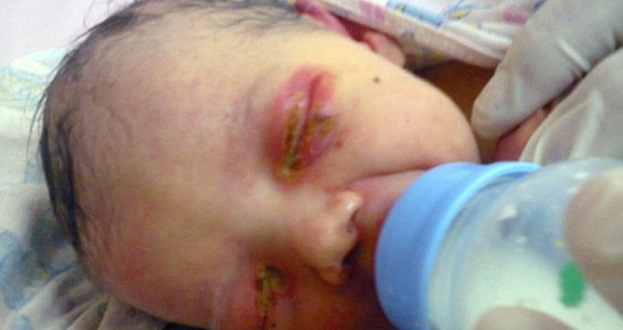 Three-day-old baby girl found covered in ant bites