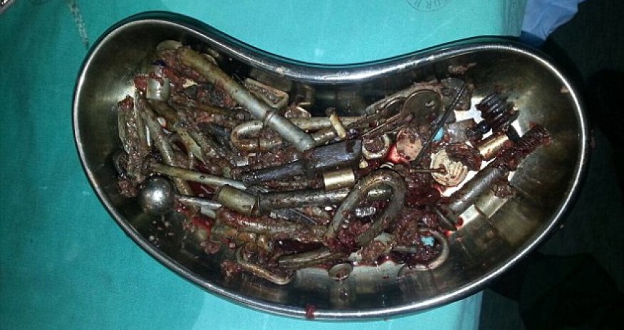 Incredible pictures of 227 metal objects - weighing 4.5lbs