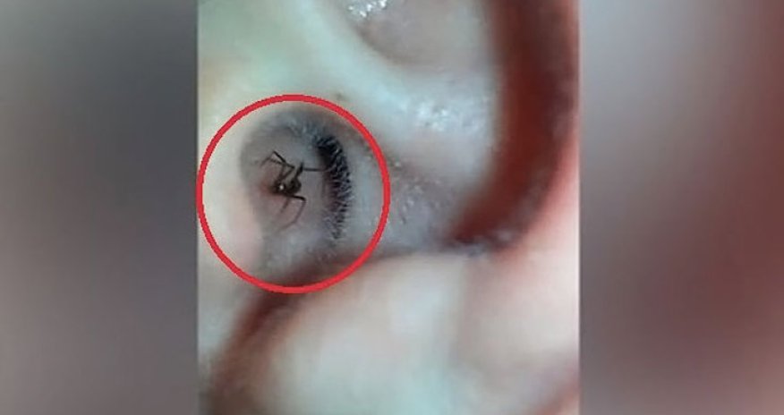 Черная вдова в ухе