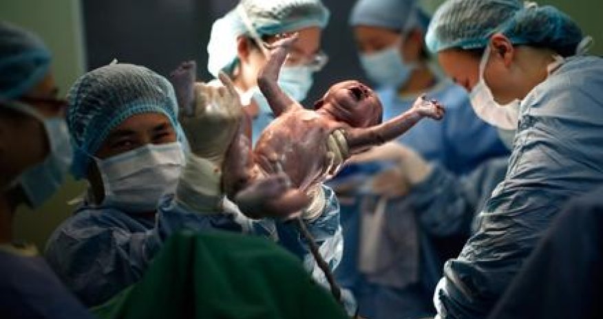 Kubadan tibb aləminə QİÇS MÜJDƏSİ