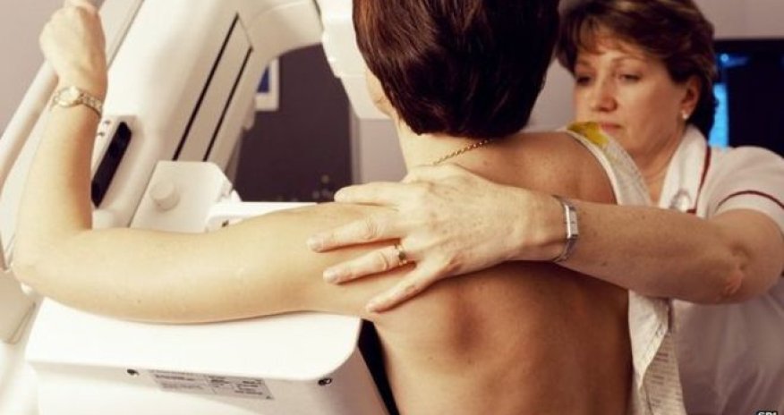 Breast cancer warning to older women