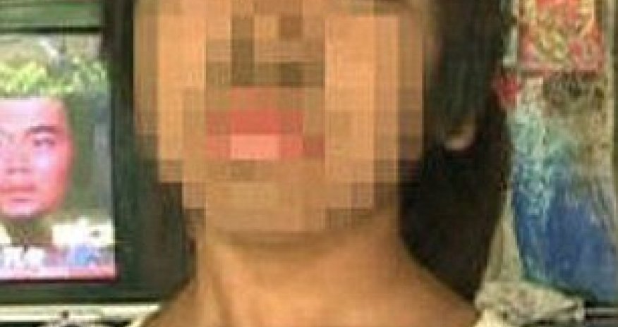 The girl covered from head to toe in coarse dark hair