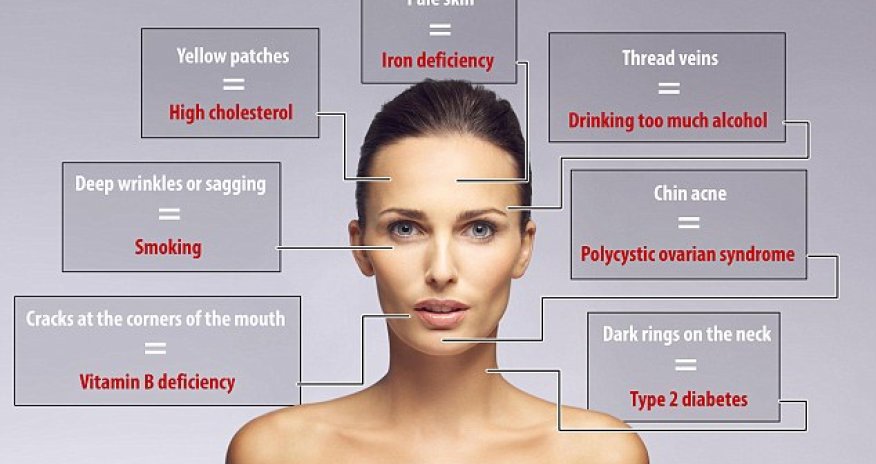 What your FACE says about your health