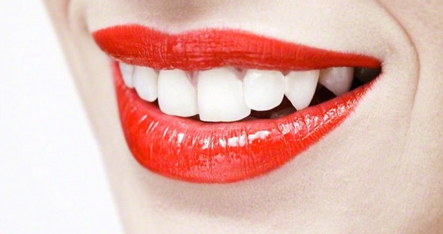 Why a splash of milk in your tea keeps teeth white