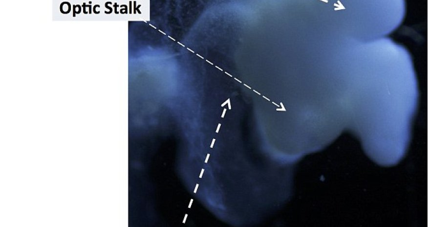 The brain grown in a LAB