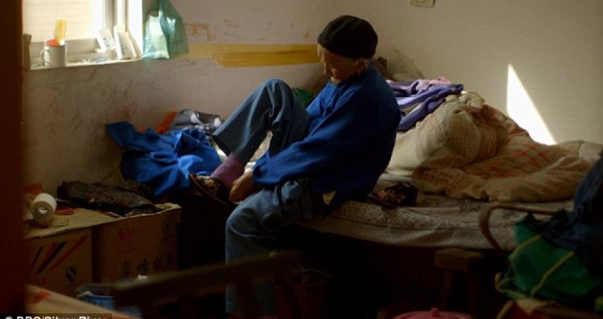 The agony of living with bound feet