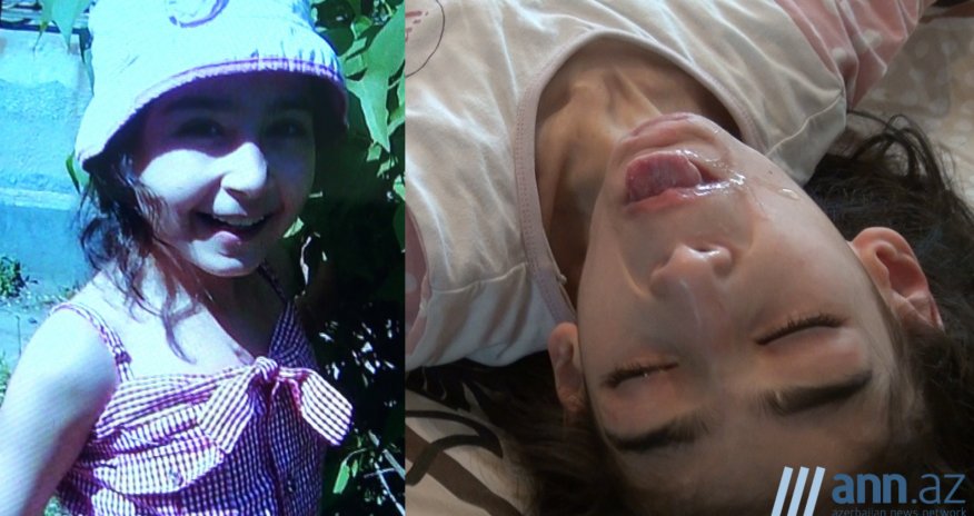 В ОБЪЕКТИКЕ: Ребенок с редкой болезнью