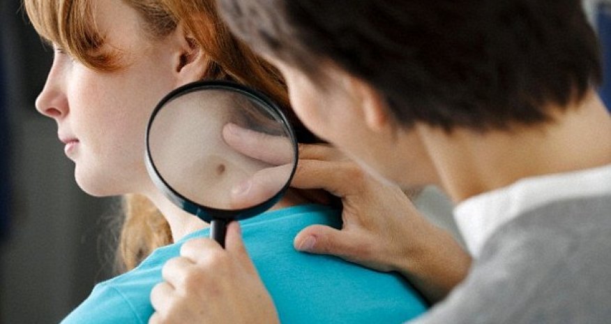Revealed.. the top 5 warning signs of cancer in young people