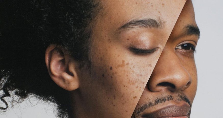 Why do women live lonnger than men?