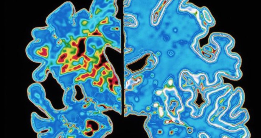 Virtual reality maze 'predicts Alzheimer's disease'