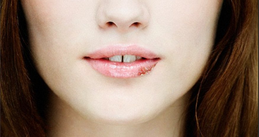 Why YOU'RE likely to have herpes