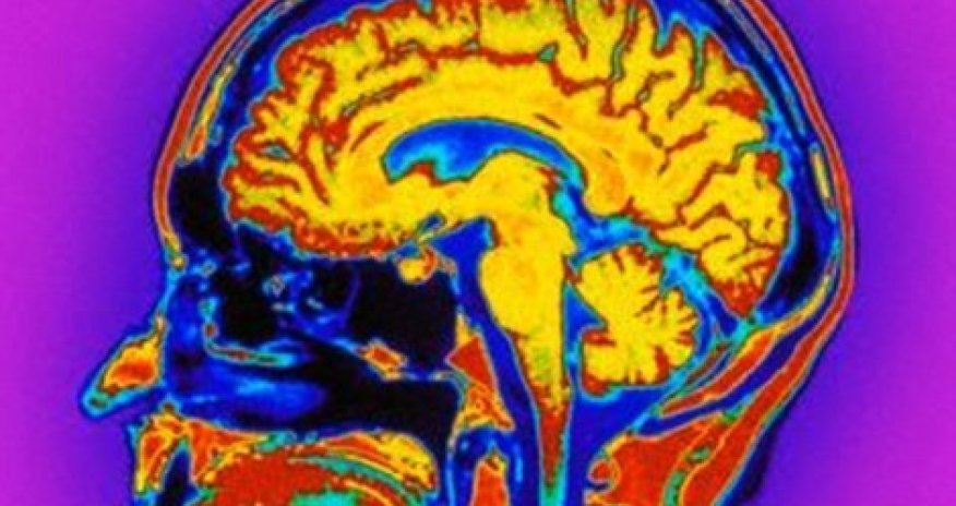 Do YOU have autistic traits?