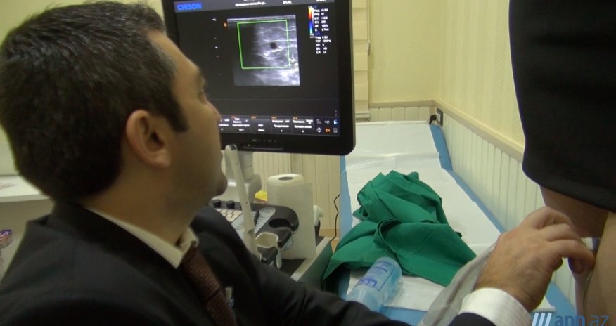 Həkim məsləhəti: Varikozun müalicəsi - ANN.TV
