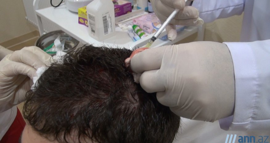 СОВЕТ ВРАЧА: Защита и восстановление волос