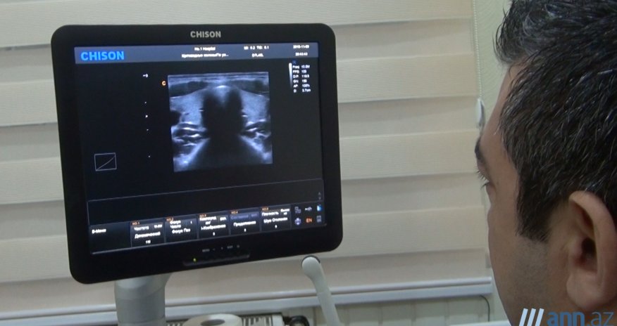 СОВЕТ ВРАЧА: Лечение зоба