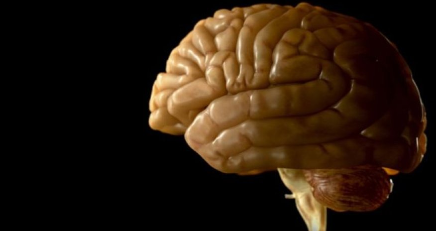 Frontal brain wrinkle linked to hallucinations