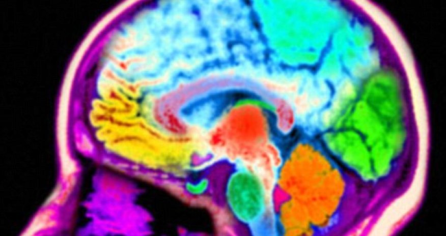 Brains of men and women are NOT different overall