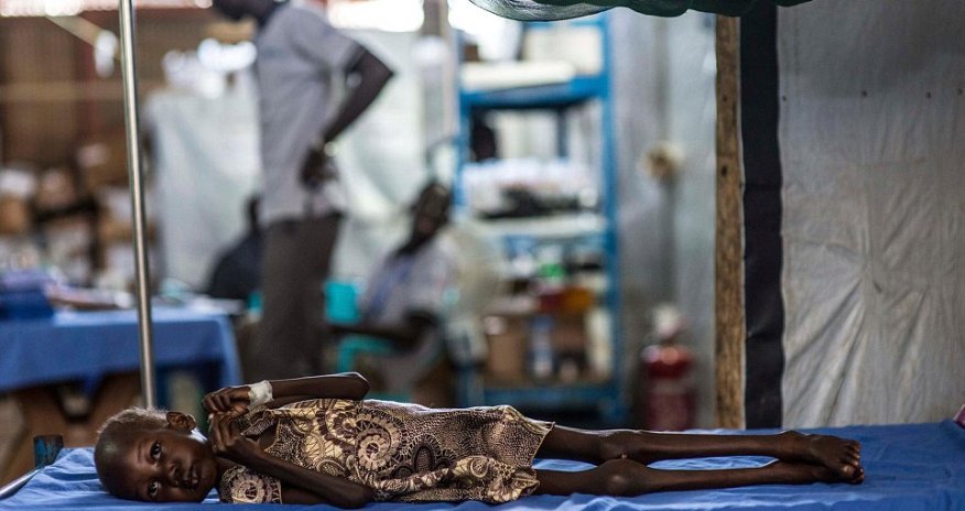 Remarkable recovery of South Sudan victim Nyajime, four