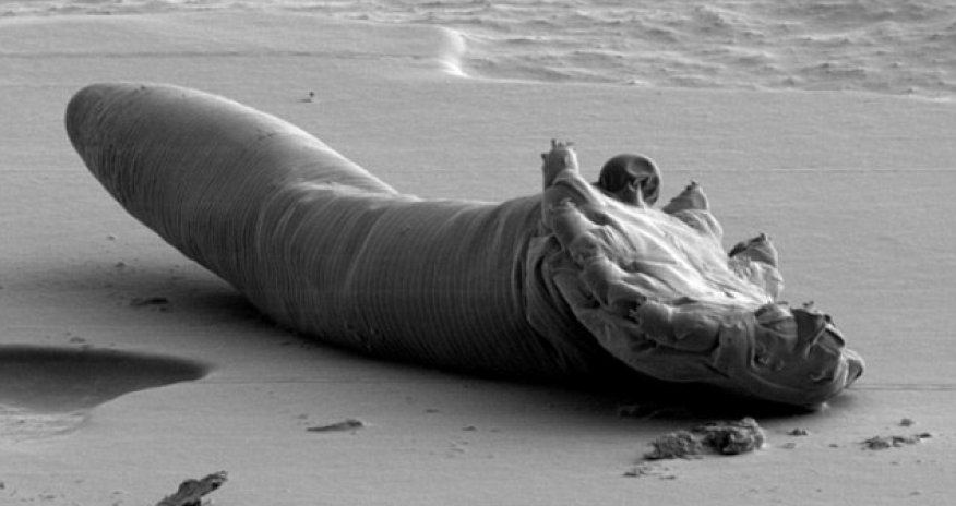 Do you have any idea what is living on your face?