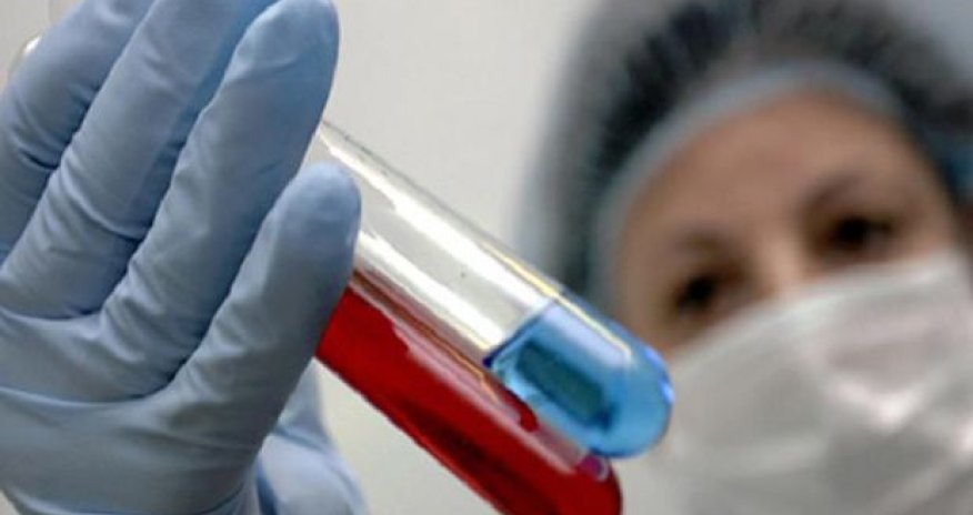 Səhiyyə Nazirliyindən “donuz qripi” ilə bağlı – AÇIQLAMA