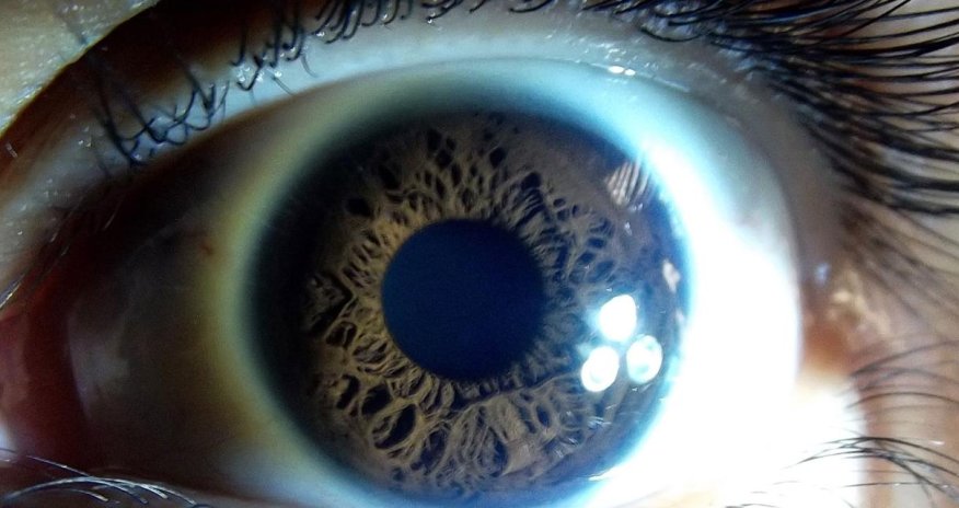 The tragic fate of the people who stop sleeping