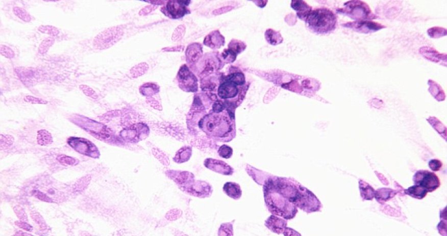 Nasa's $80,000 HERPES study