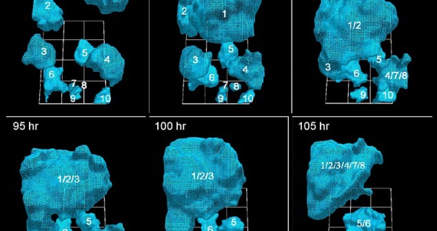 How a cancer tumor grows