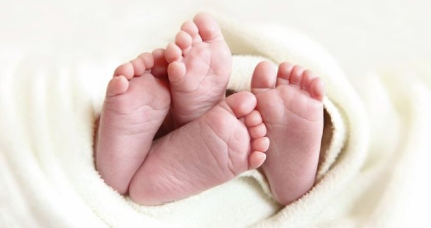 Vietnam twins found to have different fathers in rare case