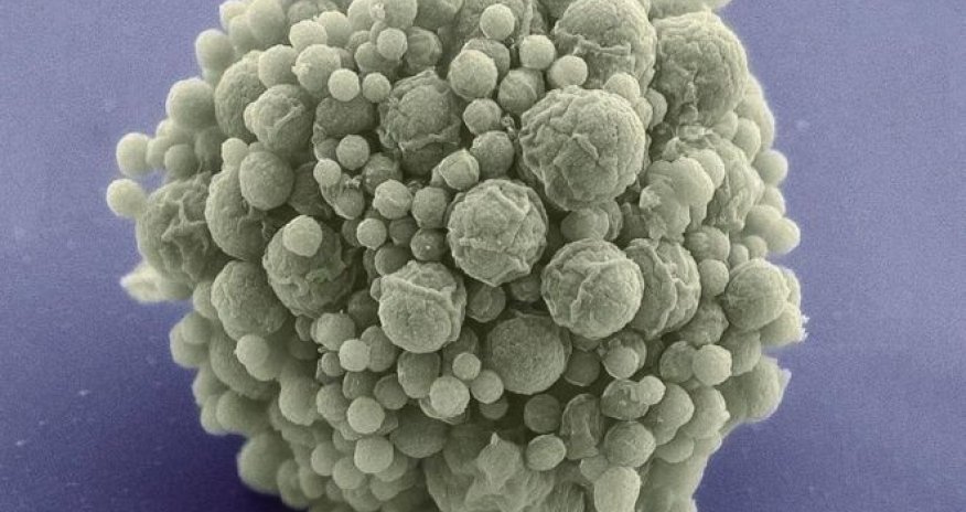 Synthetic bug given 'fewest genes'