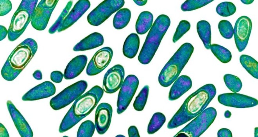 Global antibiotics 'revolution' needed