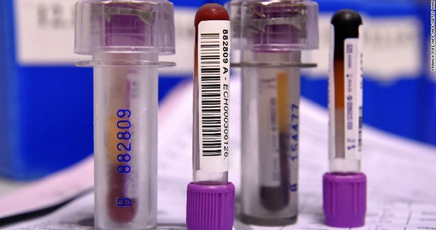 Russian agents 'threaten' drug testers