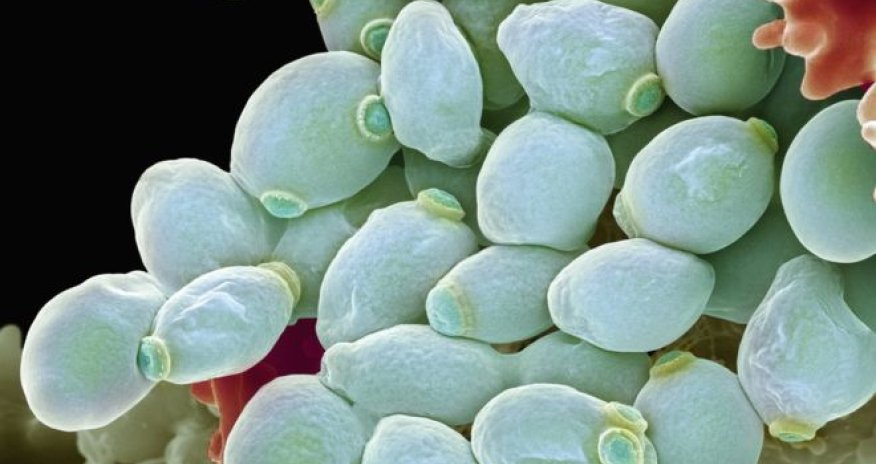 Fungal infection 'threat' to human health