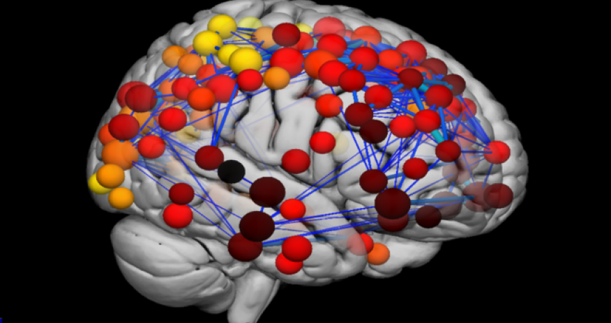 Scans reveal how teenage brain develops