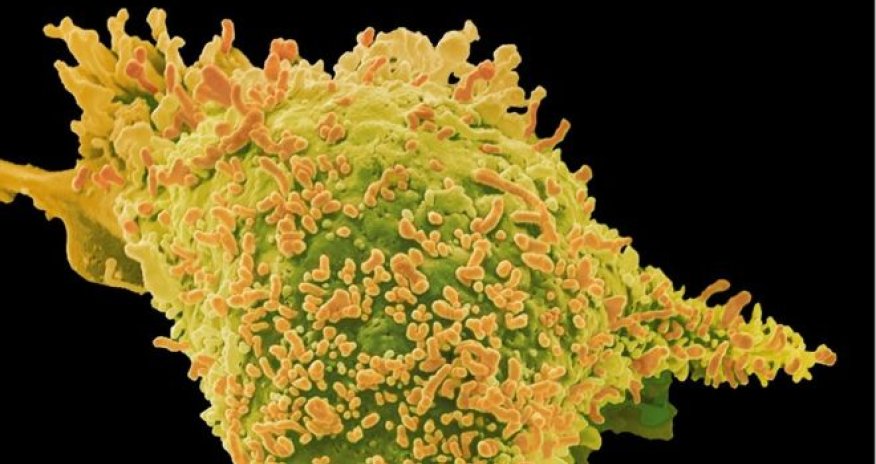 Cancer gene tests 'reveal family link'