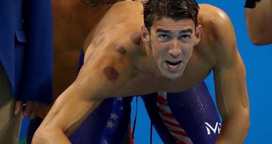 Why are so many Olympians covered in large red circles?