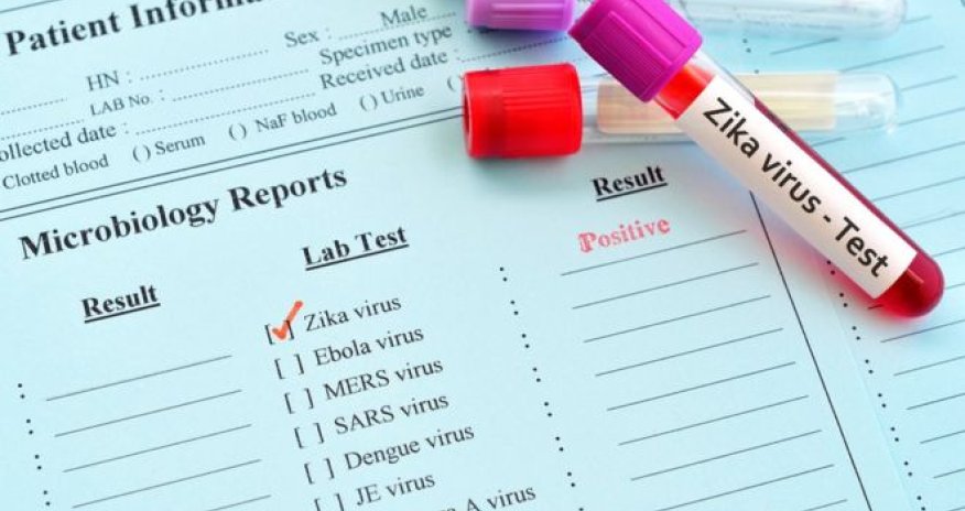 Zika found to remain in sperm for record six months