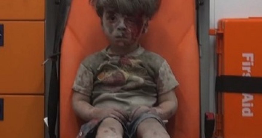 Little boy in Aleppo a vivid reminder of war`s horror