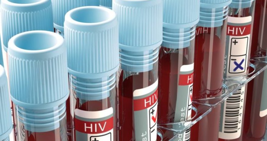 HIV effort let down by test shortages, says WHO