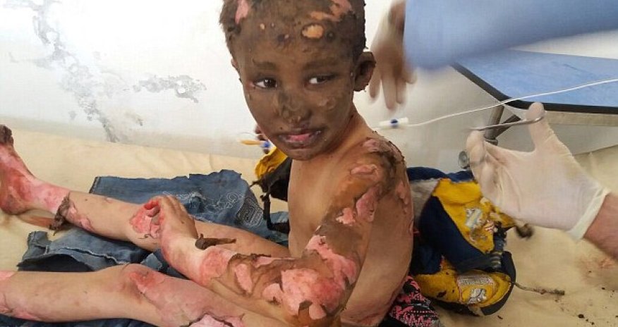 This is Syria, not Vietnam