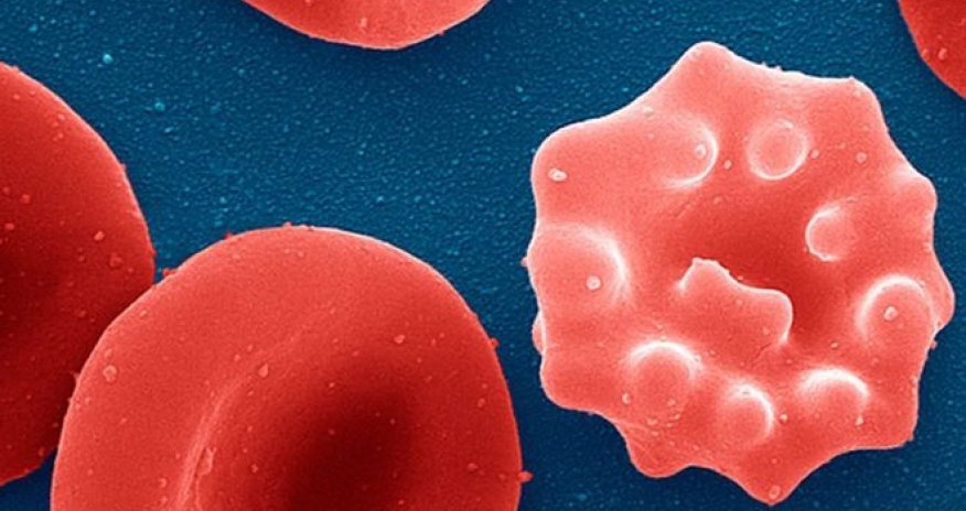 Malaria stopped with single dose of new compound