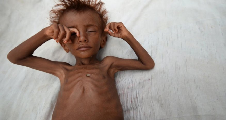 Risk of famine looms in Yemen