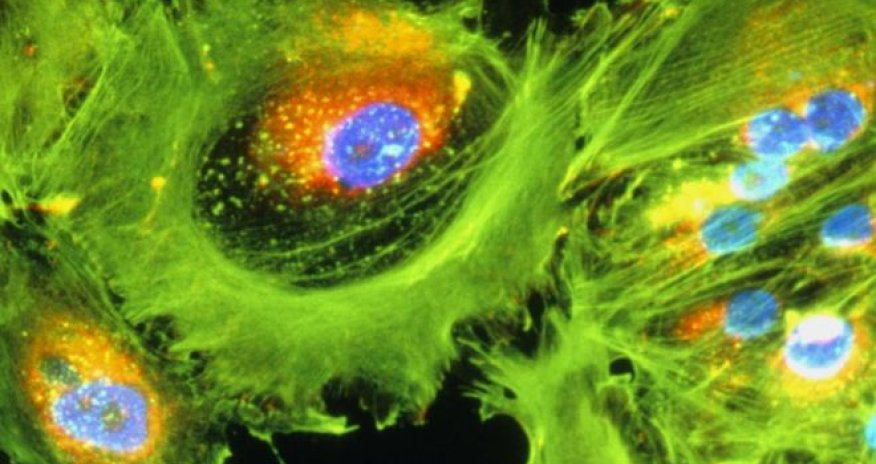 Immunotherapy cancer drug hailed as 'game changer'