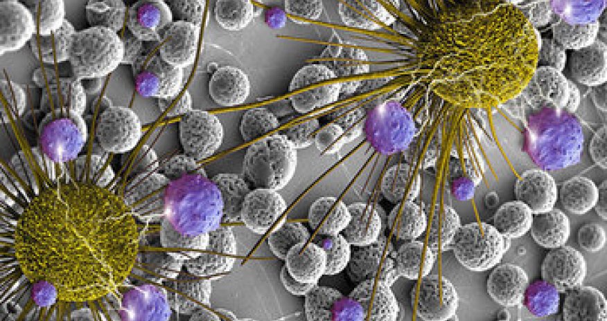 Russian scientists develop new method to destroy chemo-resistant cancer cells