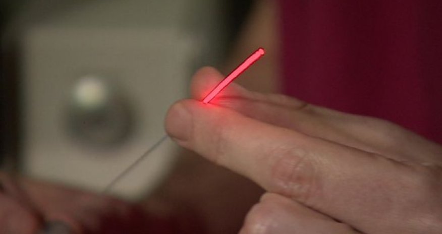 Prostate cancer laser treatment 'truly transformative'