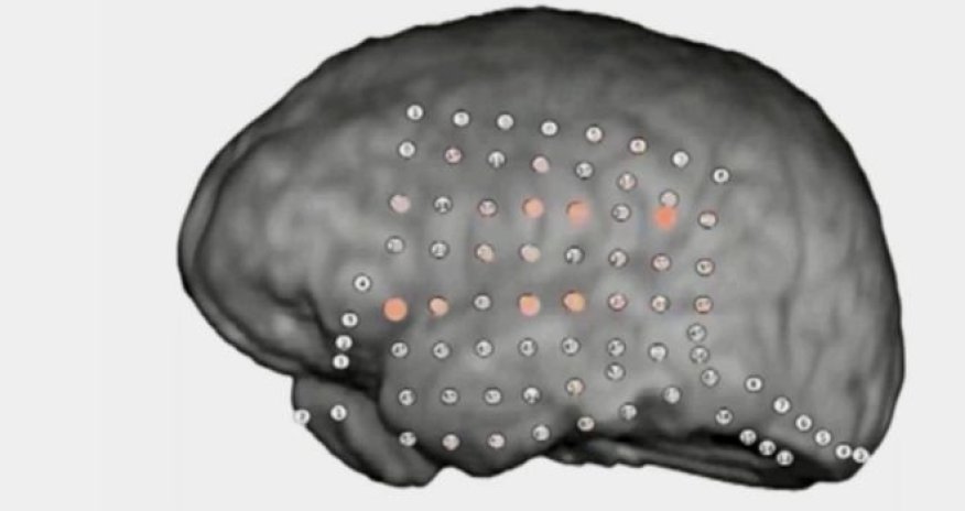 Brain's party noise filter revealed by recordings