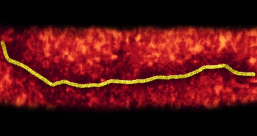 Vaccines for three deadly viruses fast-tracked