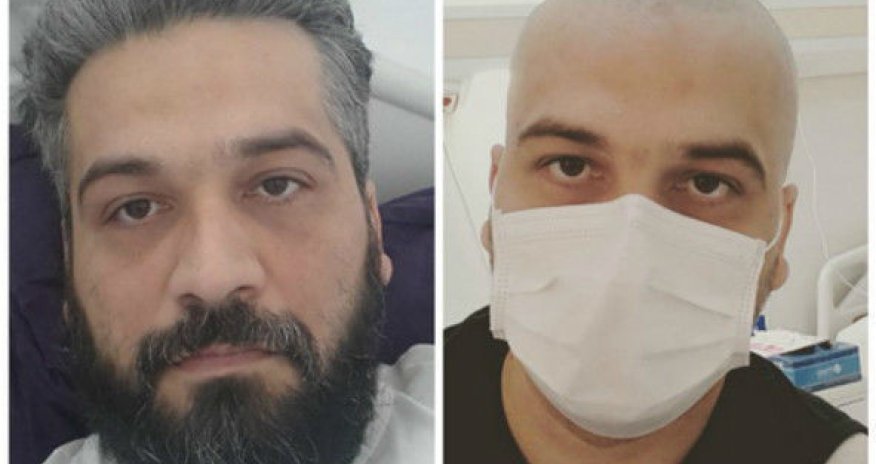 Rejissor Şahin Zəkizadə vəfat etdi