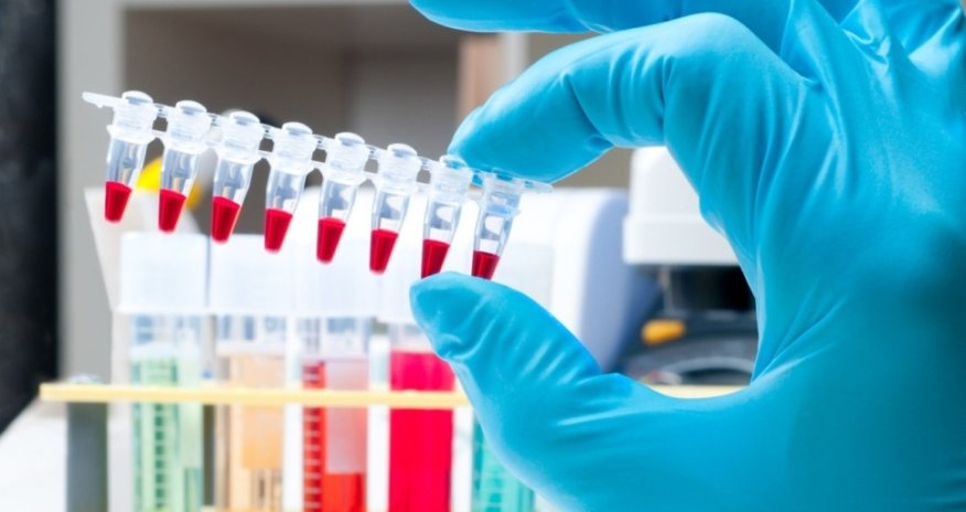 Azərbaycanda idmançının qanında morfin aşkarlanıb